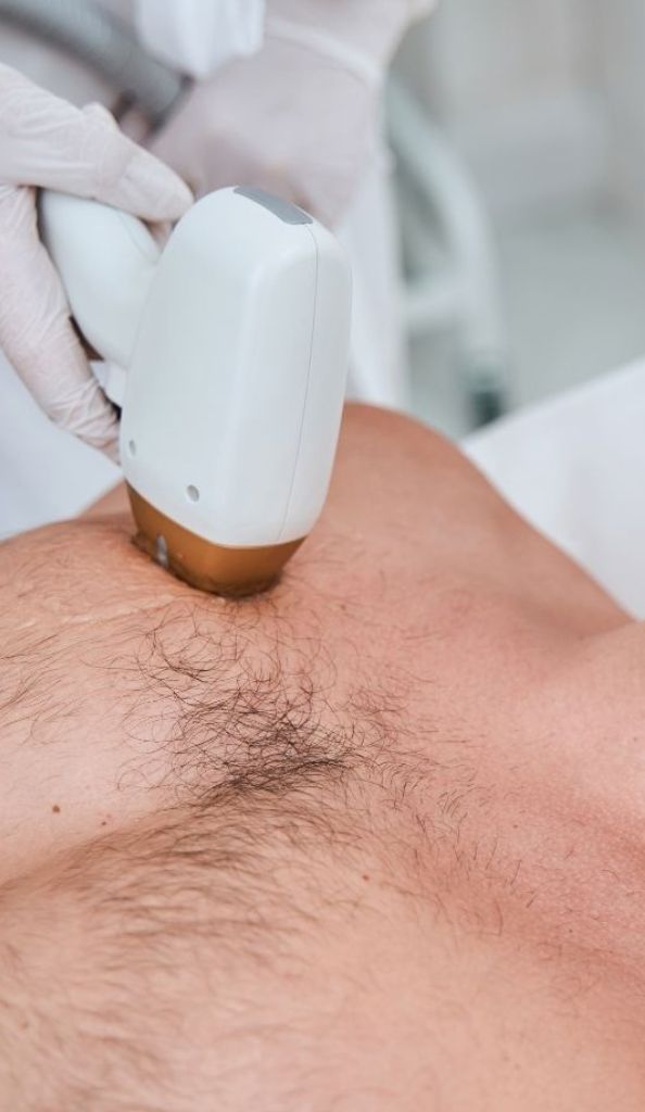 depilacion laser constanza