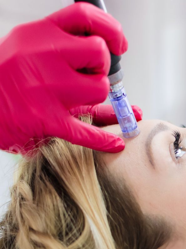 dermapen estetica constanza herrera madrid
