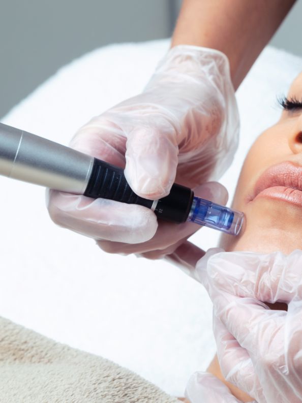 dermapen estetica