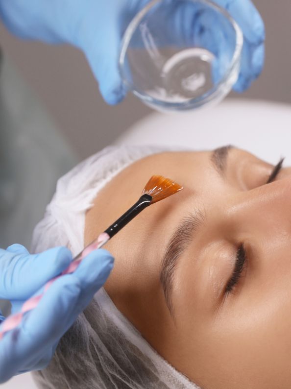 peeling quimico madrid constanza