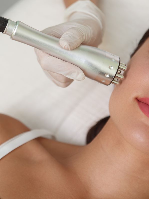 reafirmante radiofrecuencia madrid belleza